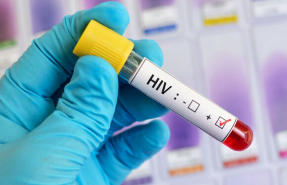 ВІЛ – виліковний! Вчені Каліфорнійського університету в Лос-Анджелесі зробили революційне відкриття